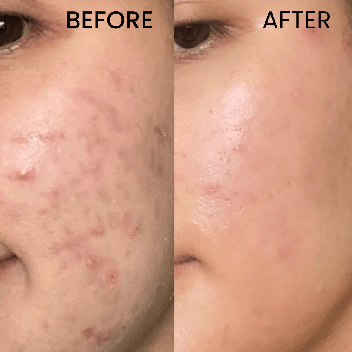 Tone It Up Glycolic Acid Toner
