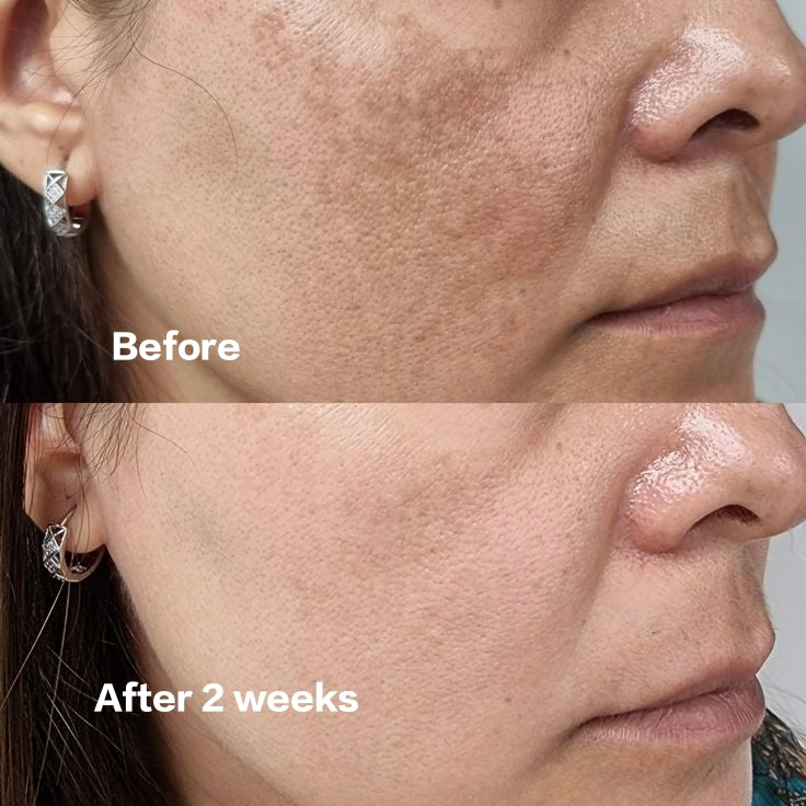 Beautix Skin Brightening Serum