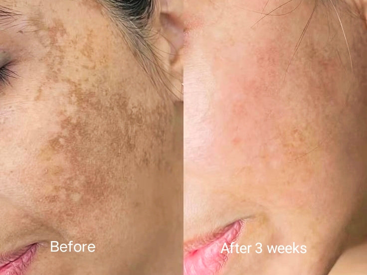 LumiMax Brightening & Rejuvenating Cream