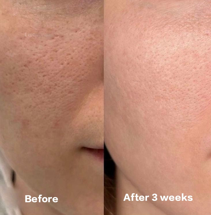 Beautix Pore Minimizer Serum
