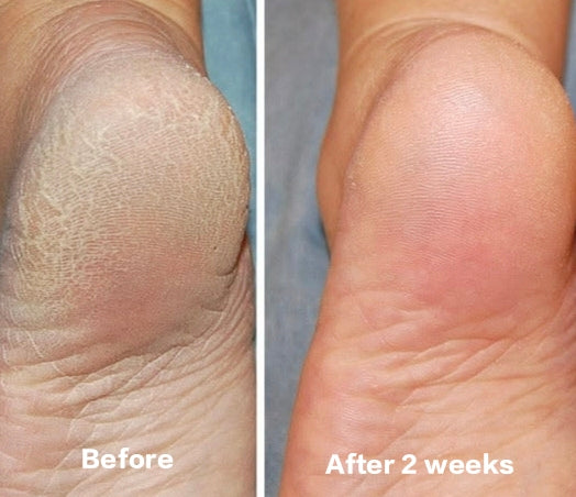 Radiance Hand & Foot Whitening Cream
