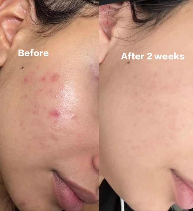 Beautix Face Wash