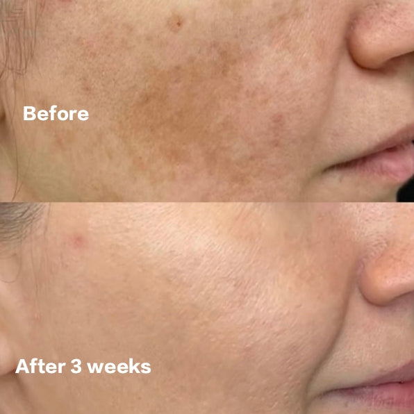 Beautix Vitamin C Serum