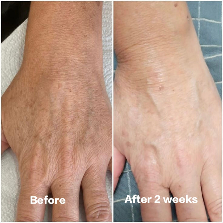 Radiance Hand & Foot Whitening Cream