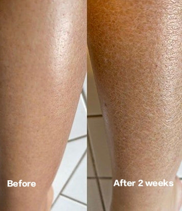Lumiderm Moisturizing Lotion