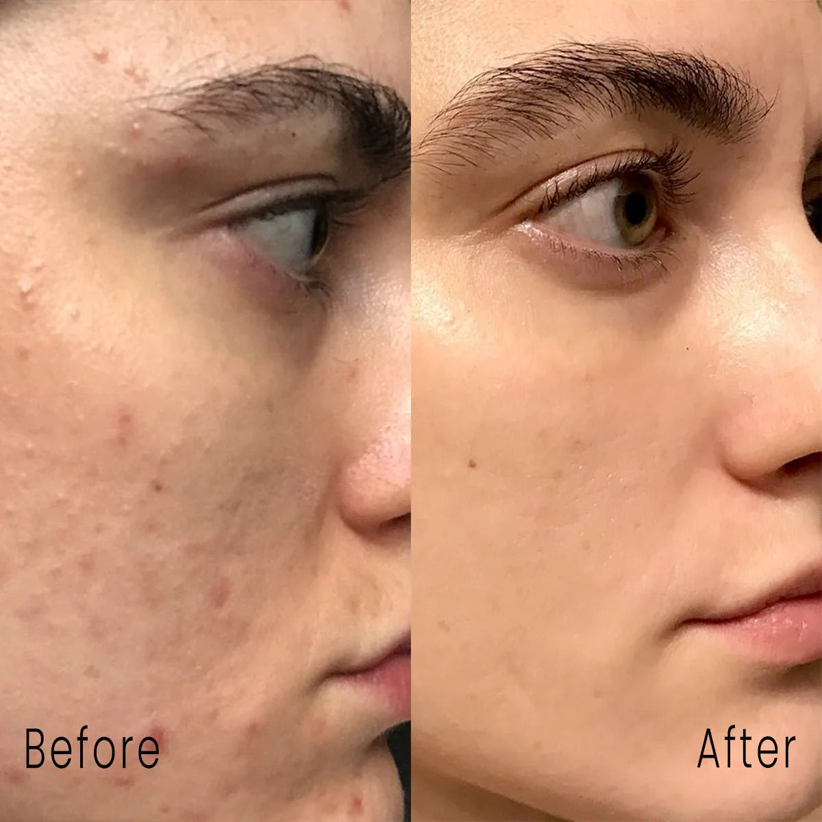Mandy Clear Facewash