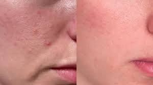 Derma White Spectra Glow Sunblock Gel