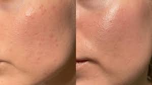 Beautix Brightening Cream